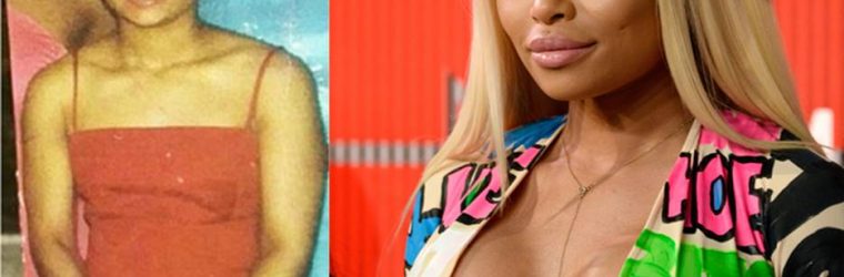 Blac Chyna Before and After