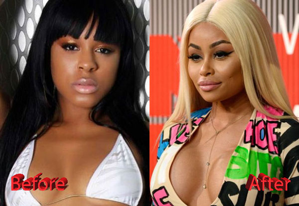 Blac Chyna Before and After