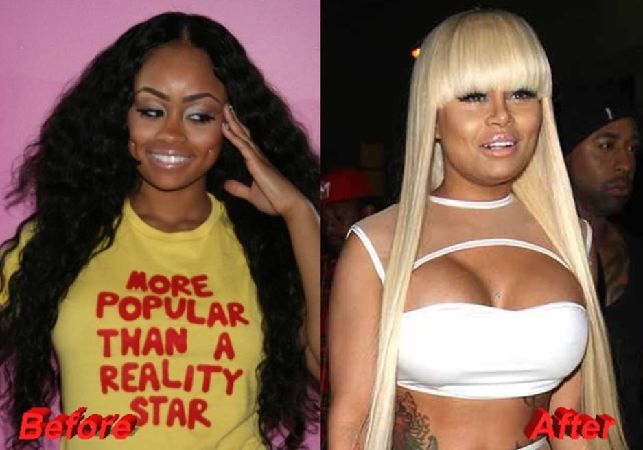 Blac Chyna Before and After