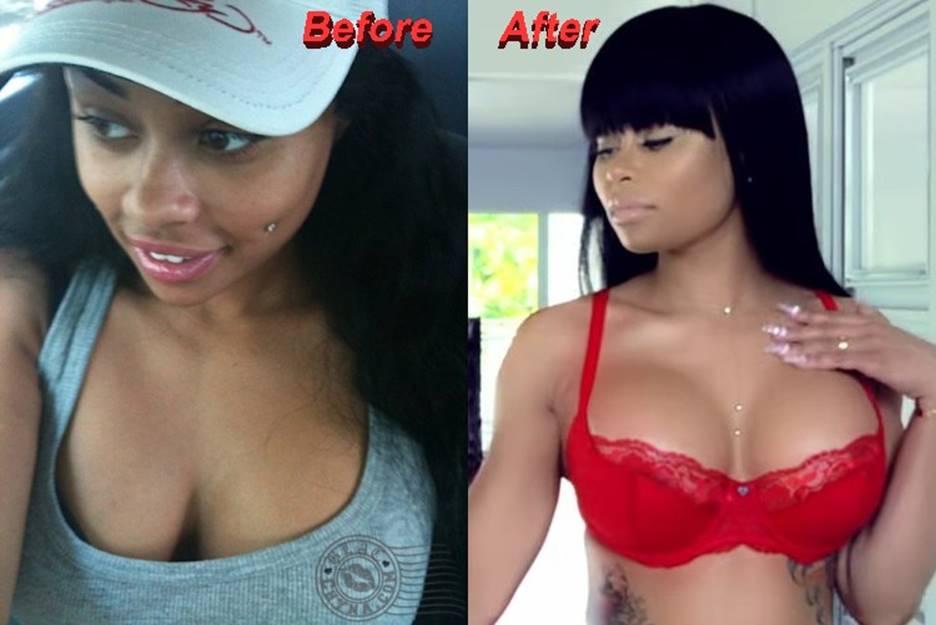 Blac Chyna Before and After