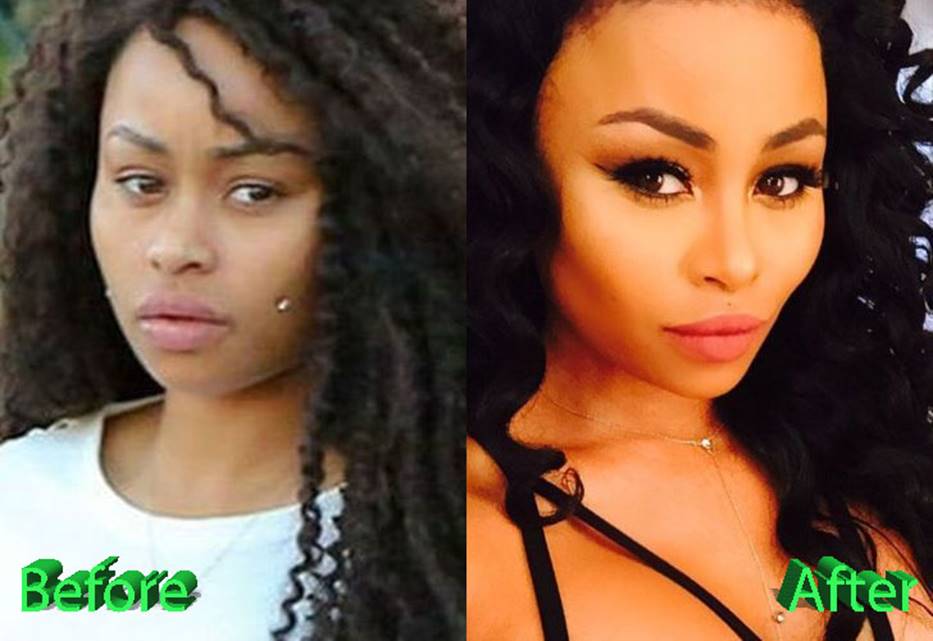 Blac Chyna Before and After